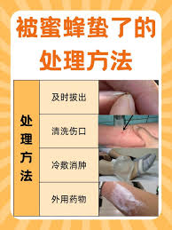 遭遇蜜蜂蜇伤后如何有效拔除残留的毒刺及其处理方法