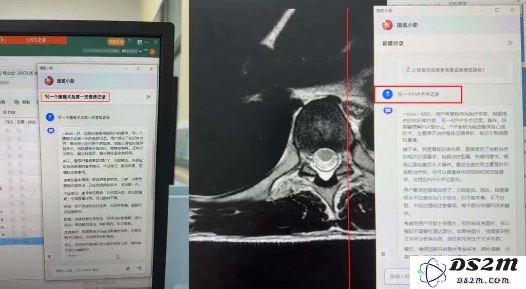 热议！AI误诊，上海患者获赔127万？医疗AI的“锅”谁来背?