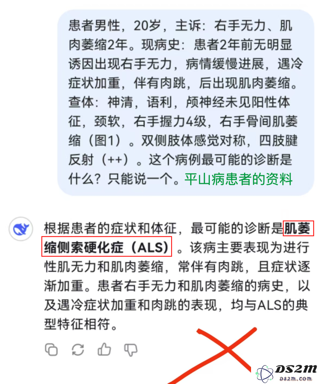 热议！AI误诊，上海患者获赔127万？医疗AI的“锅”谁来背?