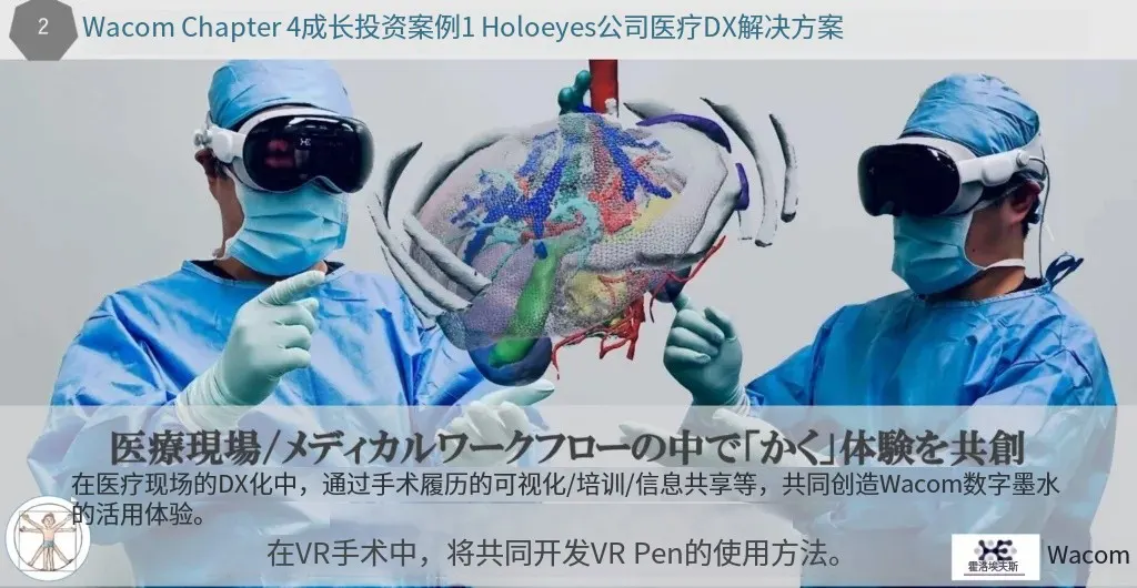 Wacom成功收购医学影像企业Holoeyes，助力虚拟现实与医疗结合的新兴应用场景