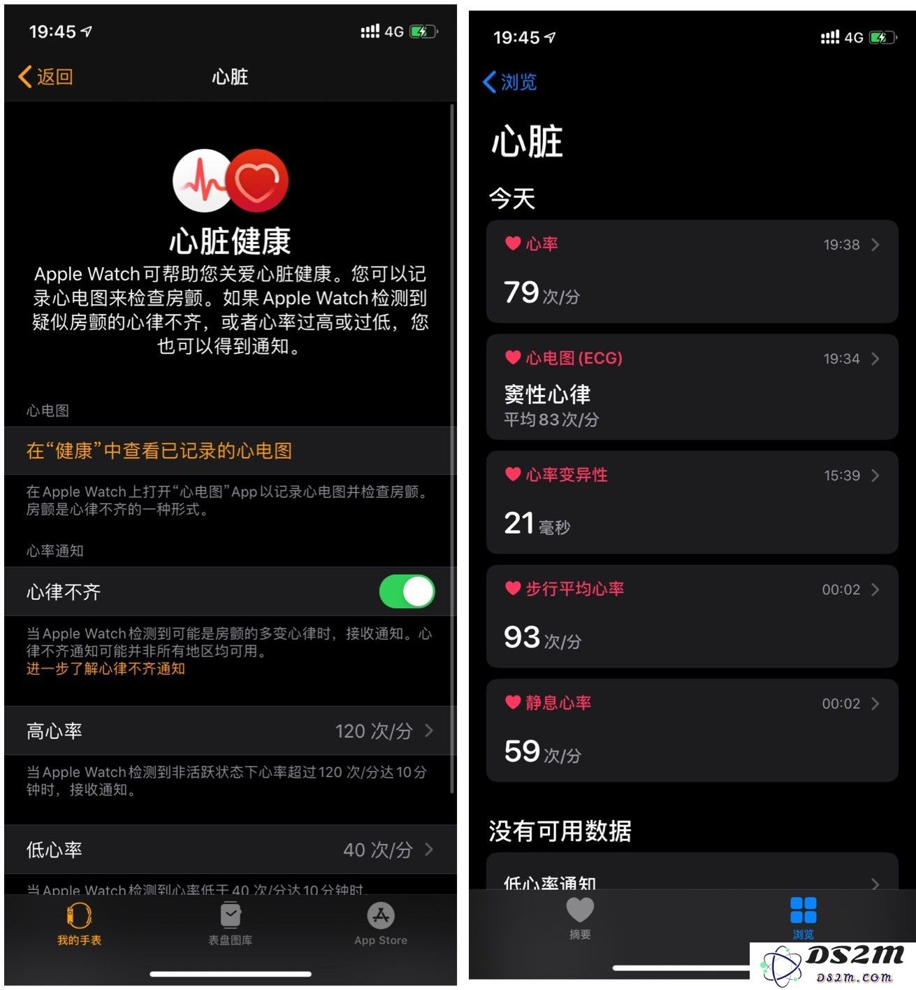 如何在国行版 Apple Watch 上成功激活心电图 ECG 功能的详细步骤及注意事项