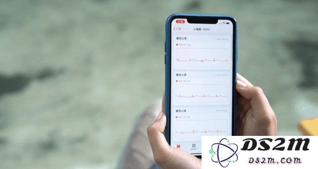 国行版本的 Apple Watch 如何激活使用 ECG 心电图功能？